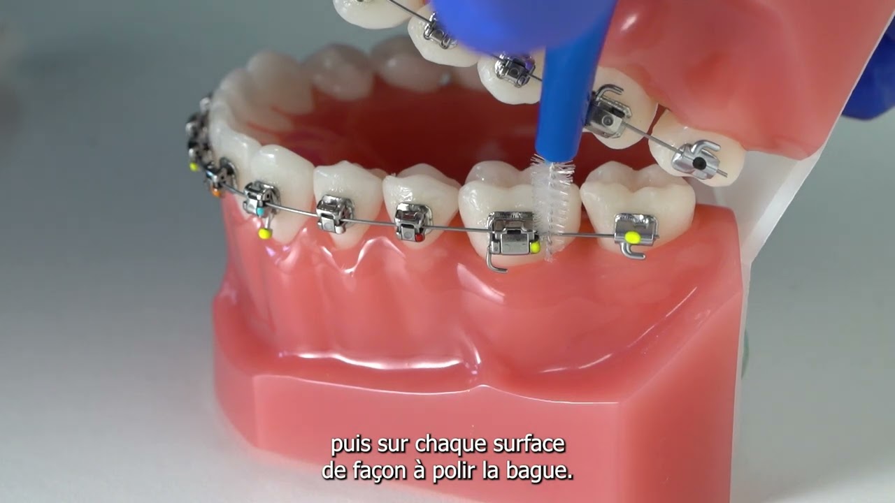 🦷 Comment utiliser des brossettes pour une hygiène bucco-dentaire irréprochable ?