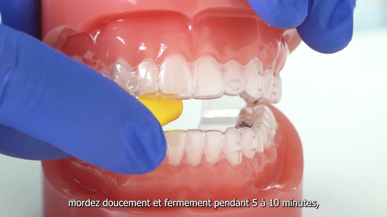 Comment optimiser l’efficacité de votre traitement orthodontique invisible grâce aux chewies