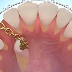 OrthoUp__229_compresse