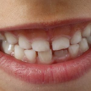 comment_brosser_ses_dents